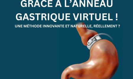 Perte de poids grâce à l’anneau gastrique virtuel : une méthode innovante et naturelle, réellement ?